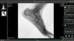 radiografia-rayosx